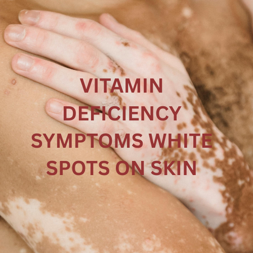 vitamin deficiency symptoms white spots on skin